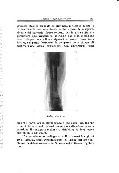 Archivio di ortopedia pubblicazione ufficiale del Pio istituto dei rachitici <1924-1950>