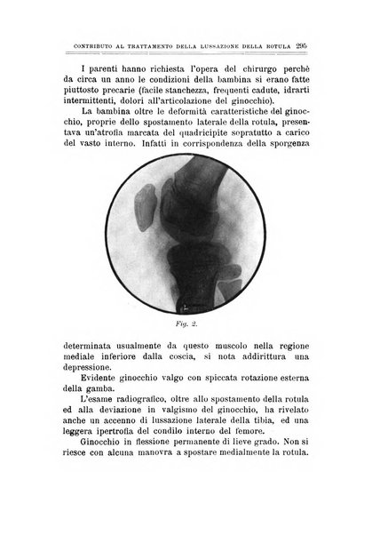 Archivio di ortopedia pubblicazione ufficiale del Pio istituto dei rachitici <1924-1950>