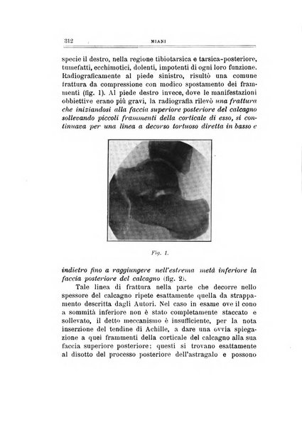 Archivio di ortopedia pubblicazione ufficiale del Pio istituto dei rachitici <1924-1950>