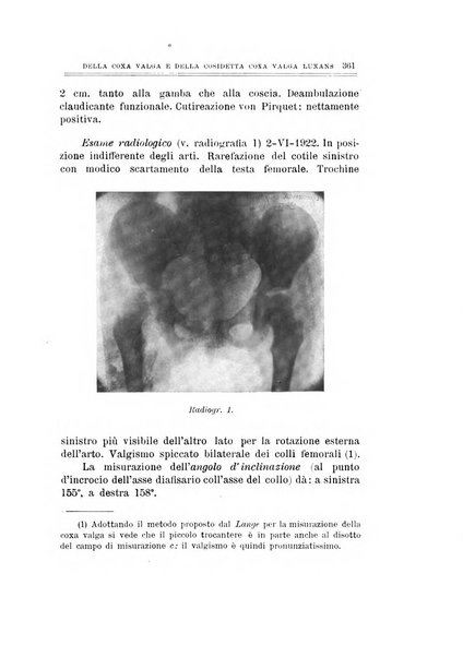 Archivio di ortopedia pubblicazione ufficiale del Pio istituto dei rachitici <1924-1950>