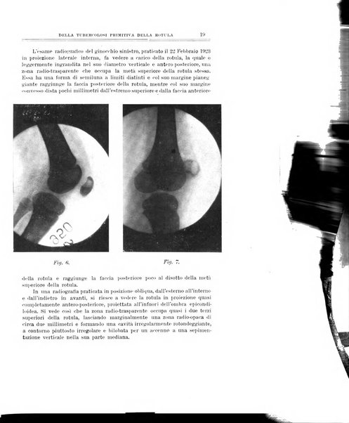 Archivio di ortopedia pubblicazione ufficiale del Pio istituto dei rachitici <1924-1950>