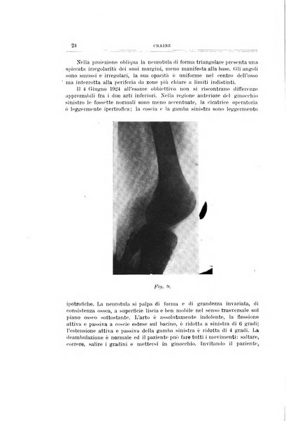 Archivio di ortopedia pubblicazione ufficiale del Pio istituto dei rachitici <1924-1950>