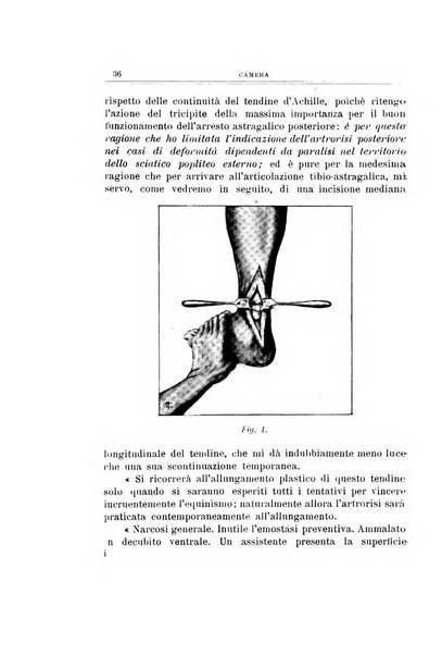 Archivio di ortopedia pubblicazione ufficiale del Pio istituto dei rachitici <1924-1950>