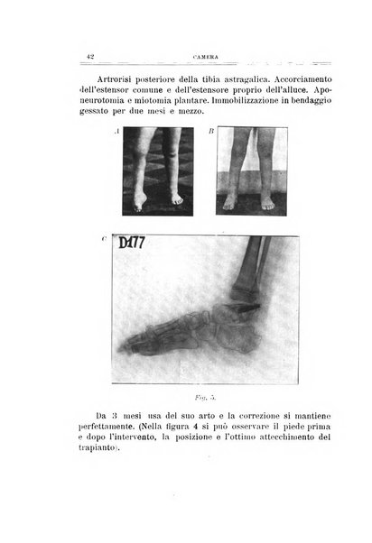 Archivio di ortopedia pubblicazione ufficiale del Pio istituto dei rachitici <1924-1950>