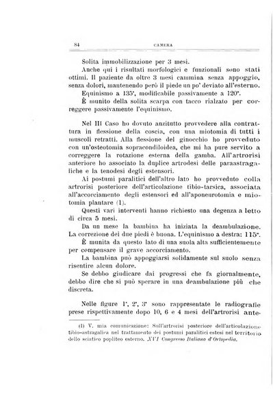 Archivio di ortopedia pubblicazione ufficiale del Pio istituto dei rachitici <1924-1950>