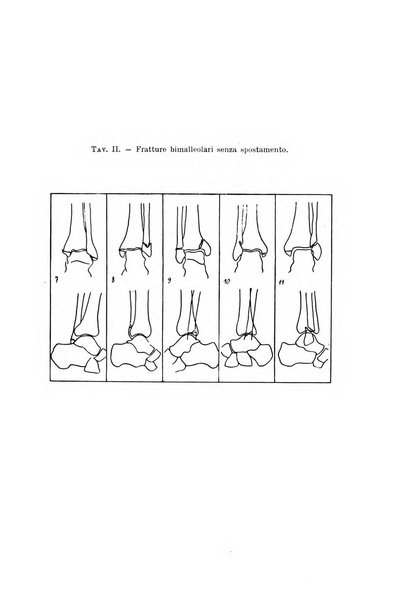 Archivio di ortopedia pubblicazione ufficiale del Pio istituto dei rachitici <1924-1950>