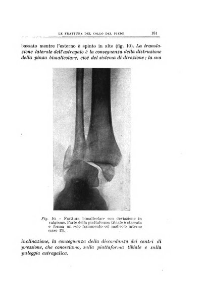 Archivio di ortopedia pubblicazione ufficiale del Pio istituto dei rachitici <1924-1950>