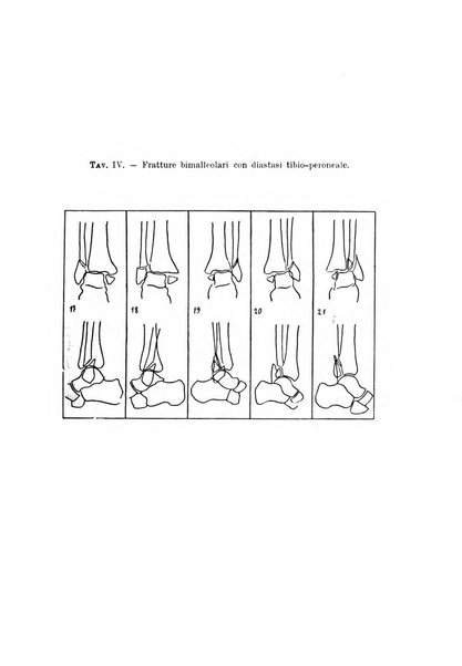 Archivio di ortopedia pubblicazione ufficiale del Pio istituto dei rachitici <1924-1950>