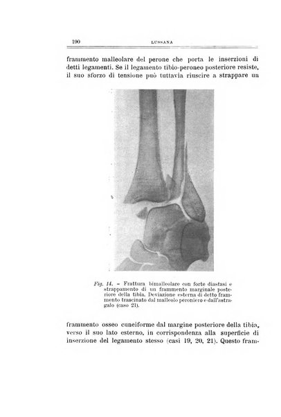 Archivio di ortopedia pubblicazione ufficiale del Pio istituto dei rachitici <1924-1950>