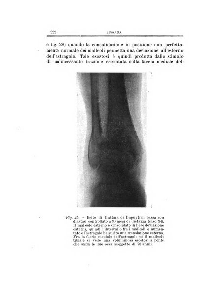 Archivio di ortopedia pubblicazione ufficiale del Pio istituto dei rachitici <1924-1950>