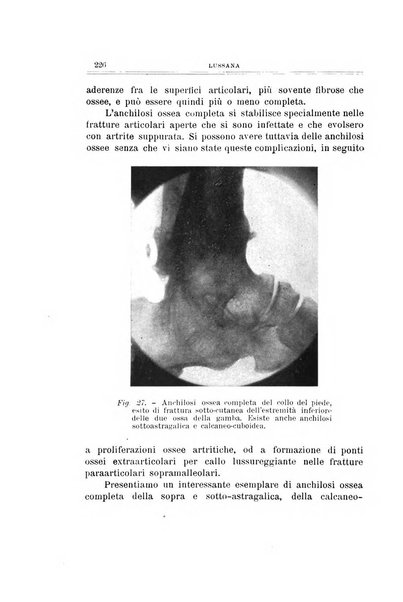 Archivio di ortopedia pubblicazione ufficiale del Pio istituto dei rachitici <1924-1950>