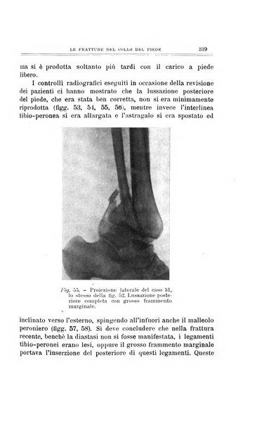 Archivio di ortopedia pubblicazione ufficiale del Pio istituto dei rachitici <1924-1950>