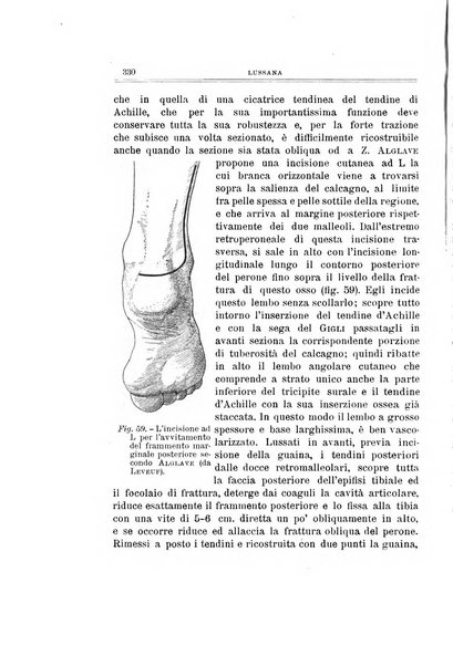 Archivio di ortopedia pubblicazione ufficiale del Pio istituto dei rachitici <1924-1950>