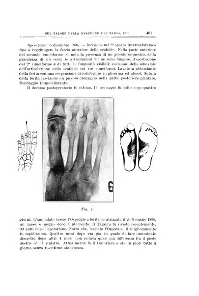 Archivio di ortopedia pubblicazione ufficiale del Pio istituto dei rachitici <1924-1950>