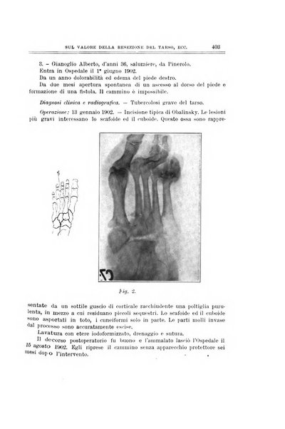 Archivio di ortopedia pubblicazione ufficiale del Pio istituto dei rachitici <1924-1950>