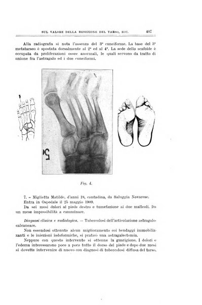 Archivio di ortopedia pubblicazione ufficiale del Pio istituto dei rachitici <1924-1950>