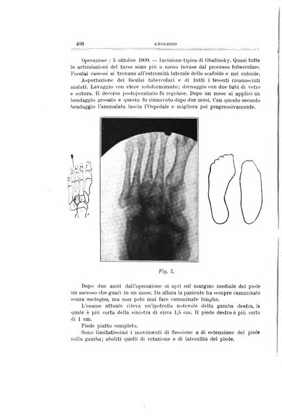 Archivio di ortopedia pubblicazione ufficiale del Pio istituto dei rachitici <1924-1950>