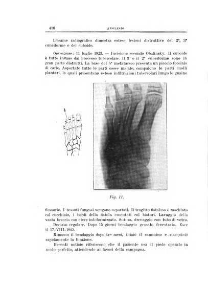 Archivio di ortopedia pubblicazione ufficiale del Pio istituto dei rachitici <1924-1950>