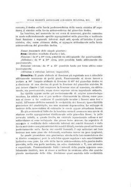 Archivio di ortopedia pubblicazione ufficiale del Pio istituto dei rachitici <1924-1950>