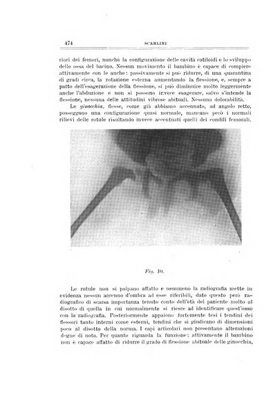 Archivio di ortopedia pubblicazione ufficiale del Pio istituto dei rachitici <1924-1950>