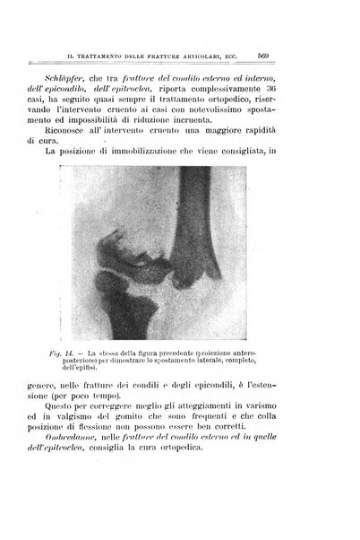 Archivio di ortopedia pubblicazione ufficiale del Pio istituto dei rachitici <1924-1950>