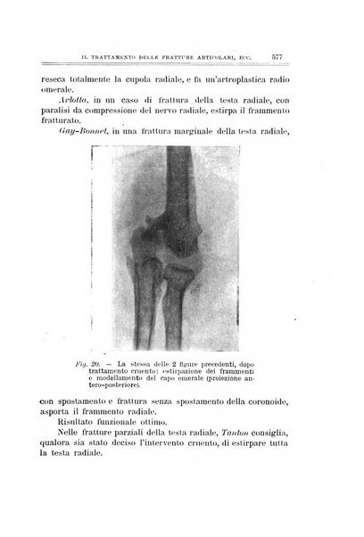 Archivio di ortopedia pubblicazione ufficiale del Pio istituto dei rachitici <1924-1950>