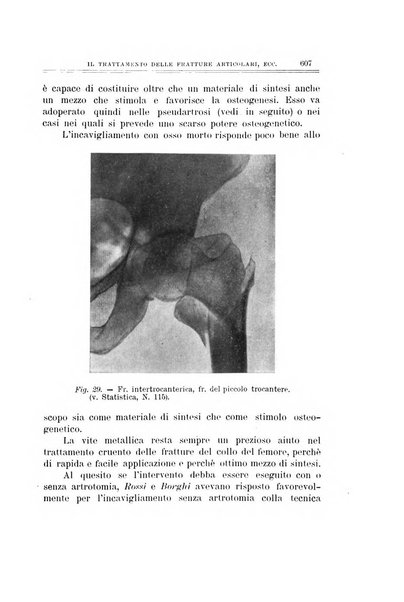 Archivio di ortopedia pubblicazione ufficiale del Pio istituto dei rachitici <1924-1950>