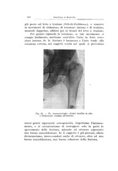 Archivio di ortopedia pubblicazione ufficiale del Pio istituto dei rachitici <1924-1950>