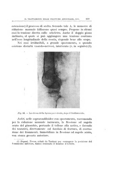 Archivio di ortopedia pubblicazione ufficiale del Pio istituto dei rachitici <1924-1950>