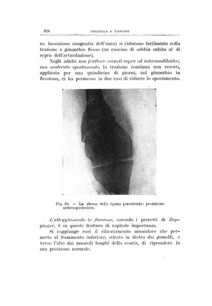 Archivio di ortopedia pubblicazione ufficiale del Pio istituto dei rachitici <1924-1950>