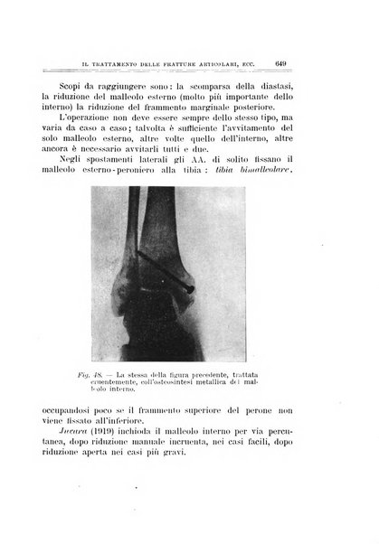 Archivio di ortopedia pubblicazione ufficiale del Pio istituto dei rachitici <1924-1950>