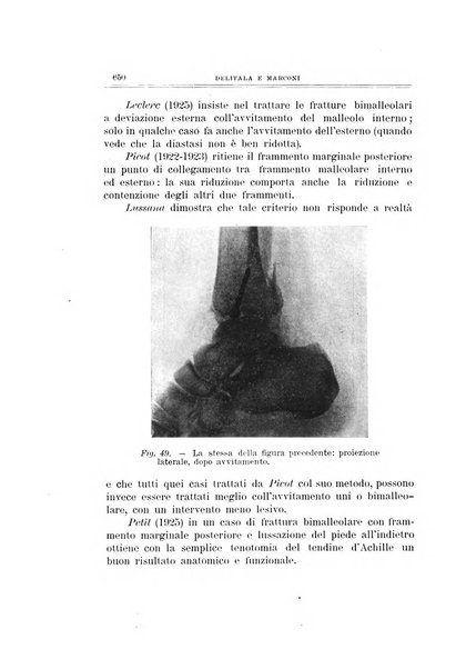 Archivio di ortopedia pubblicazione ufficiale del Pio istituto dei rachitici <1924-1950>