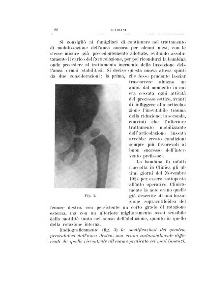 Archivio di ortopedia pubblicazione ufficiale del Pio istituto dei rachitici <1924-1950>