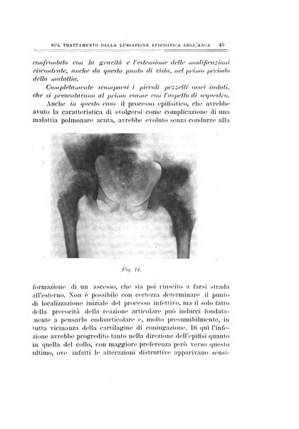 Archivio di ortopedia pubblicazione ufficiale del Pio istituto dei rachitici <1924-1950>