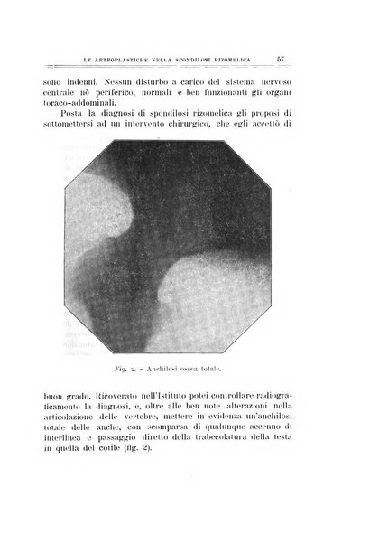 Archivio di ortopedia pubblicazione ufficiale del Pio istituto dei rachitici <1924-1950>