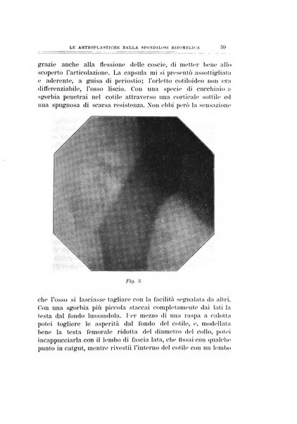 Archivio di ortopedia pubblicazione ufficiale del Pio istituto dei rachitici <1924-1950>