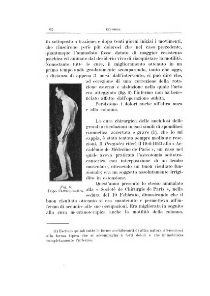 Archivio di ortopedia pubblicazione ufficiale del Pio istituto dei rachitici <1924-1950>