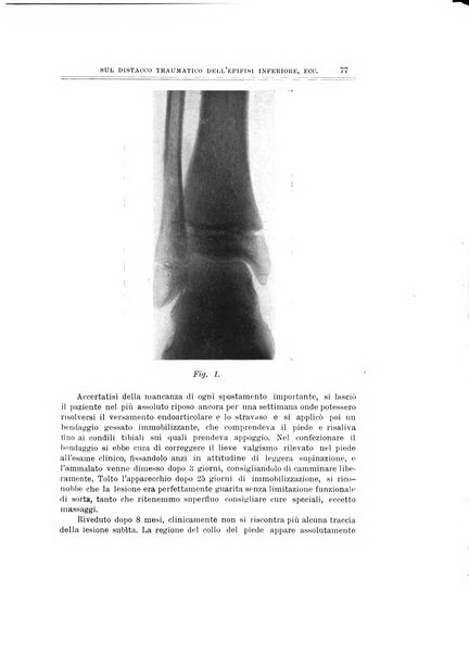 Archivio di ortopedia pubblicazione ufficiale del Pio istituto dei rachitici <1924-1950>