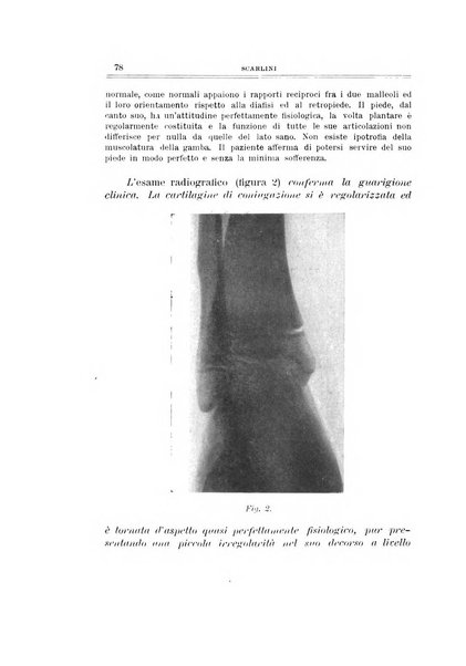 Archivio di ortopedia pubblicazione ufficiale del Pio istituto dei rachitici <1924-1950>