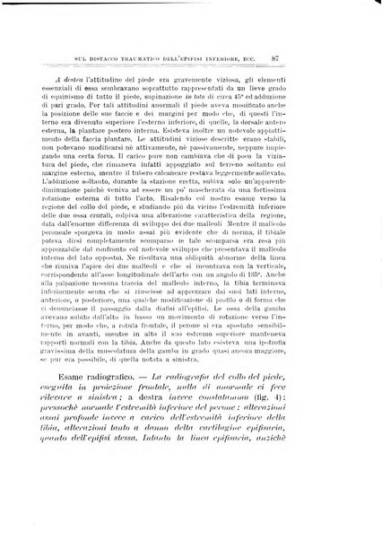 Archivio di ortopedia pubblicazione ufficiale del Pio istituto dei rachitici <1924-1950>