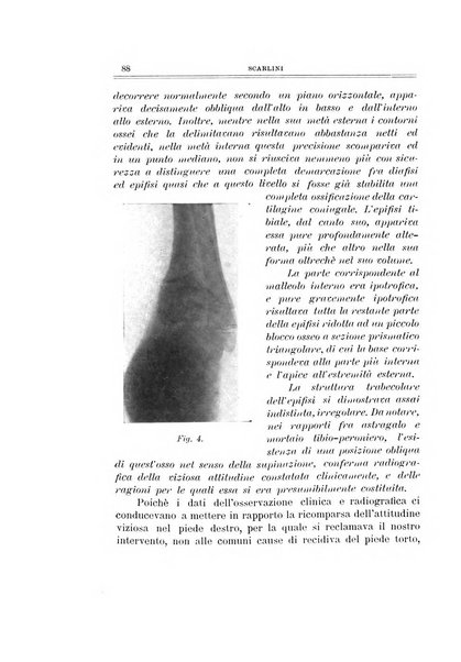 Archivio di ortopedia pubblicazione ufficiale del Pio istituto dei rachitici <1924-1950>