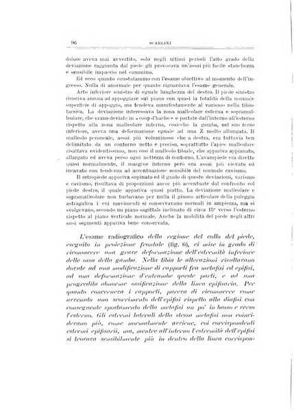 Archivio di ortopedia pubblicazione ufficiale del Pio istituto dei rachitici <1924-1950>