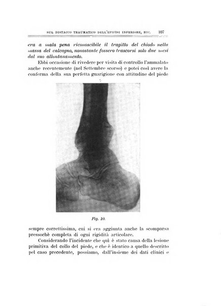 Archivio di ortopedia pubblicazione ufficiale del Pio istituto dei rachitici <1924-1950>