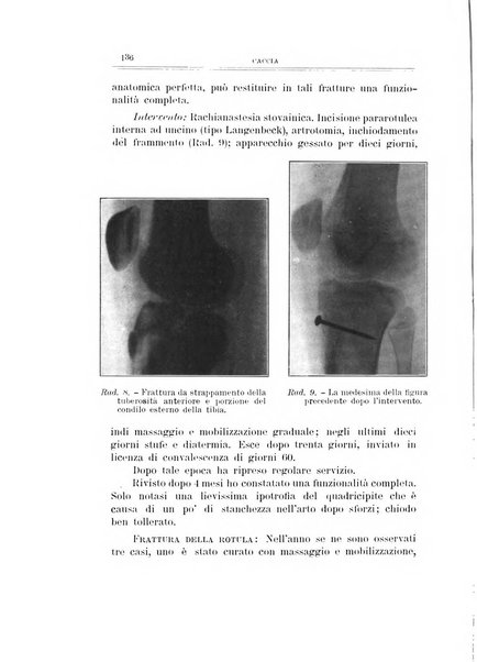 Archivio di ortopedia pubblicazione ufficiale del Pio istituto dei rachitici <1924-1950>