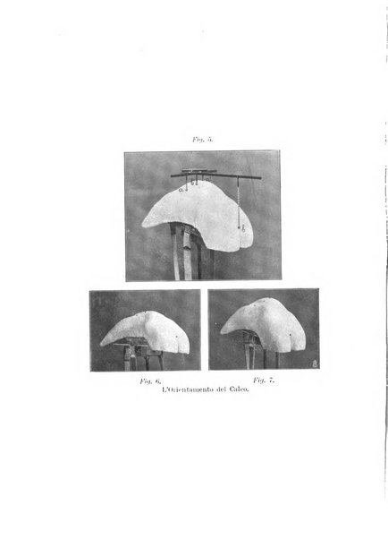 Archivio di ortopedia pubblicazione ufficiale del Pio istituto dei rachitici <1924-1950>