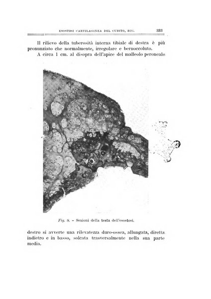 Archivio di ortopedia pubblicazione ufficiale del Pio istituto dei rachitici <1924-1950>