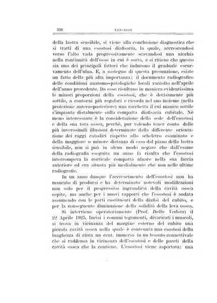 Archivio di ortopedia pubblicazione ufficiale del Pio istituto dei rachitici <1924-1950>