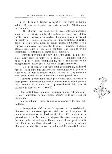 Archivio di ortopedia pubblicazione ufficiale del Pio istituto dei rachitici <1924-1950>