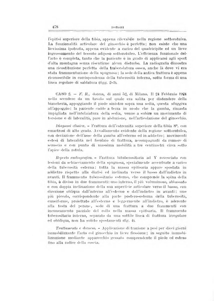 Archivio di ortopedia pubblicazione ufficiale del Pio istituto dei rachitici <1924-1950>