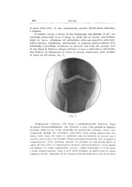 Archivio di ortopedia pubblicazione ufficiale del Pio istituto dei rachitici <1924-1950>